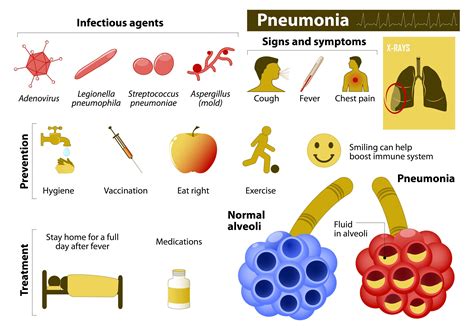 pneumonia pega